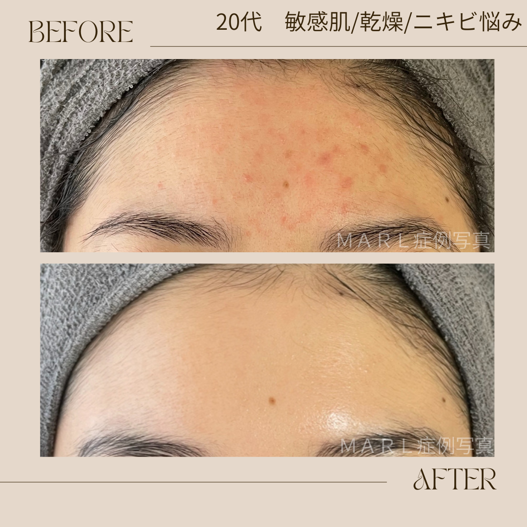 ハイドレートレストアセラム